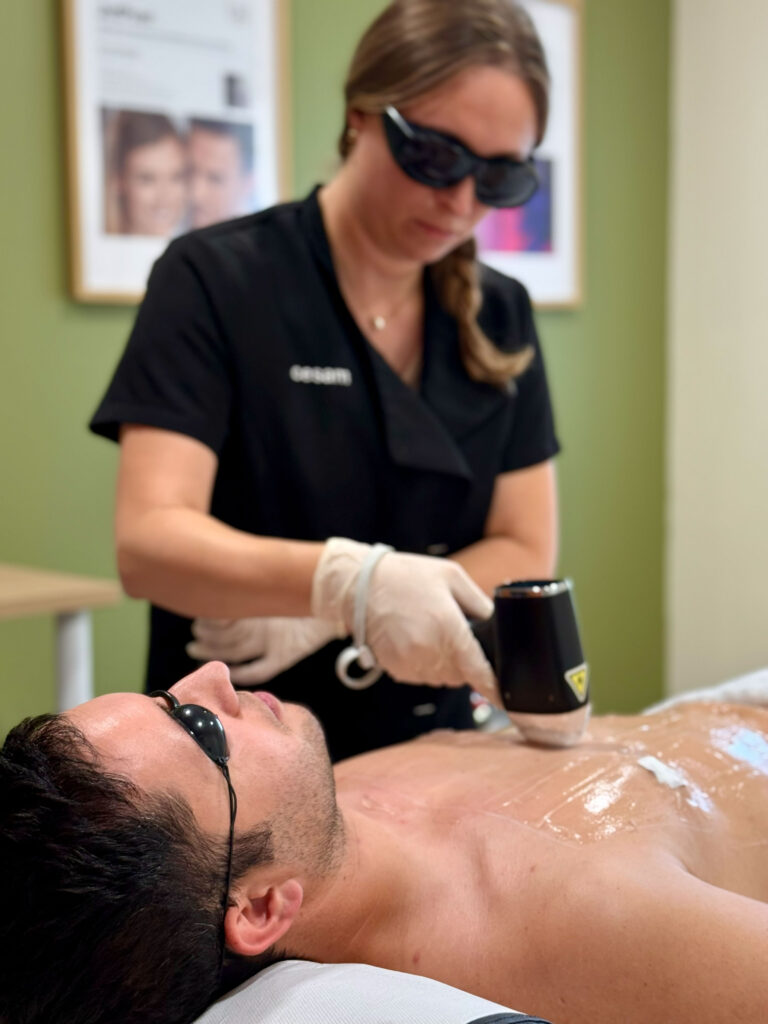 Séance d'épilation laser sur le torse d'un client allongé : la praticienne et le client portent des lunettes de protection